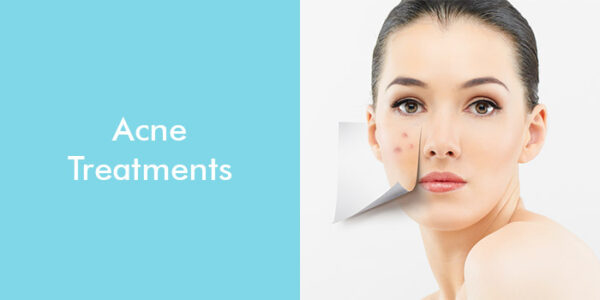 Acne Treatments - Dermalogic Laser Center - Hammonton, NJ